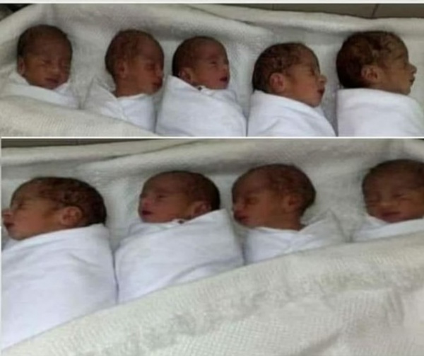 9 em bé trong ca sinh 9 chấn động cả thế giới nửa năm trước giờ ra sao?
