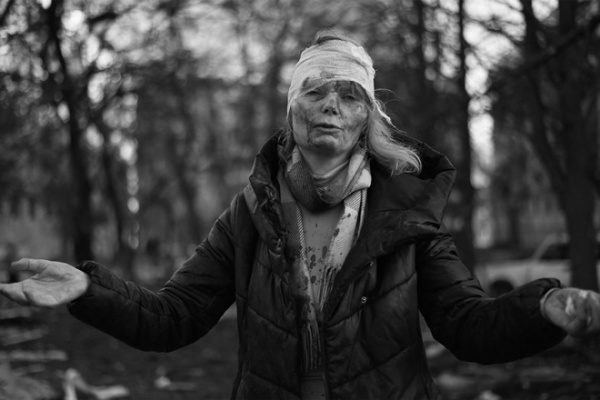 Nữ giáo viên mặt đầy máu, bố khóc tạm biệt con trước khi ly tán trong cuộc xung đột Nga-Ukraine